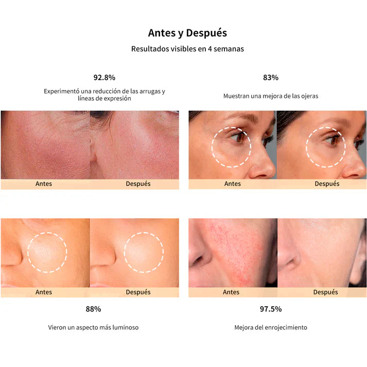DermaPro 4D