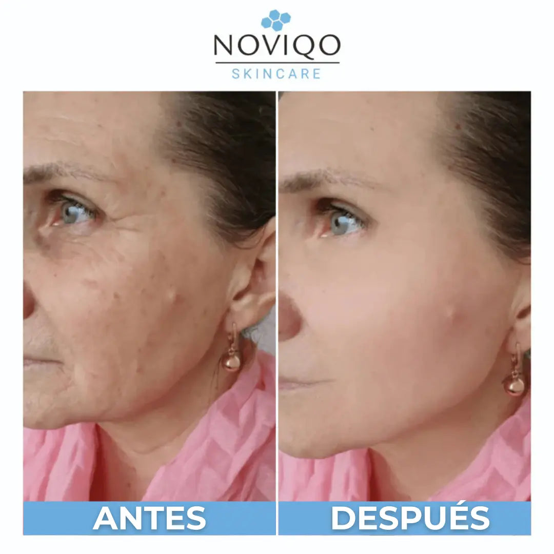 Noviqo - Colágeno de nanoseda antiarrugas liofilizado