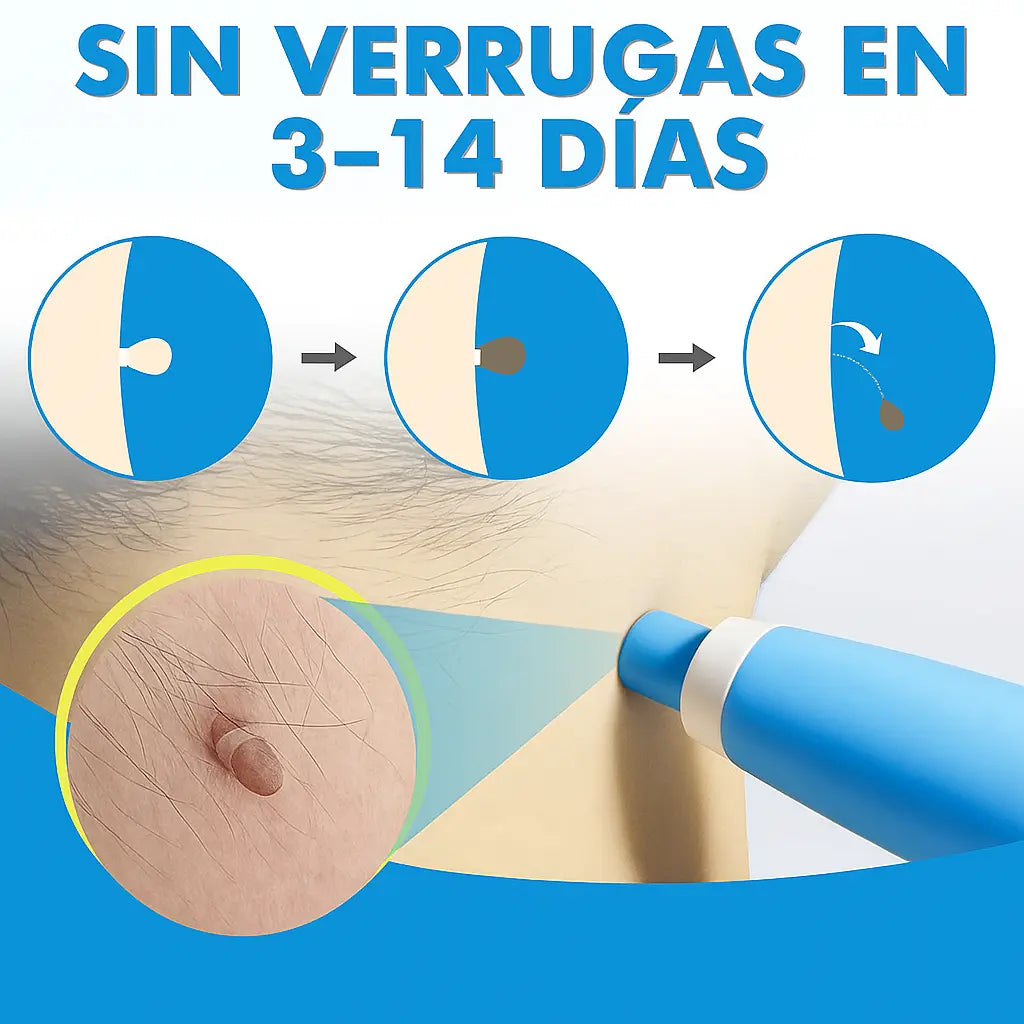 AutoSkin Tag - Lápiz para eliminar lunares y verrugas