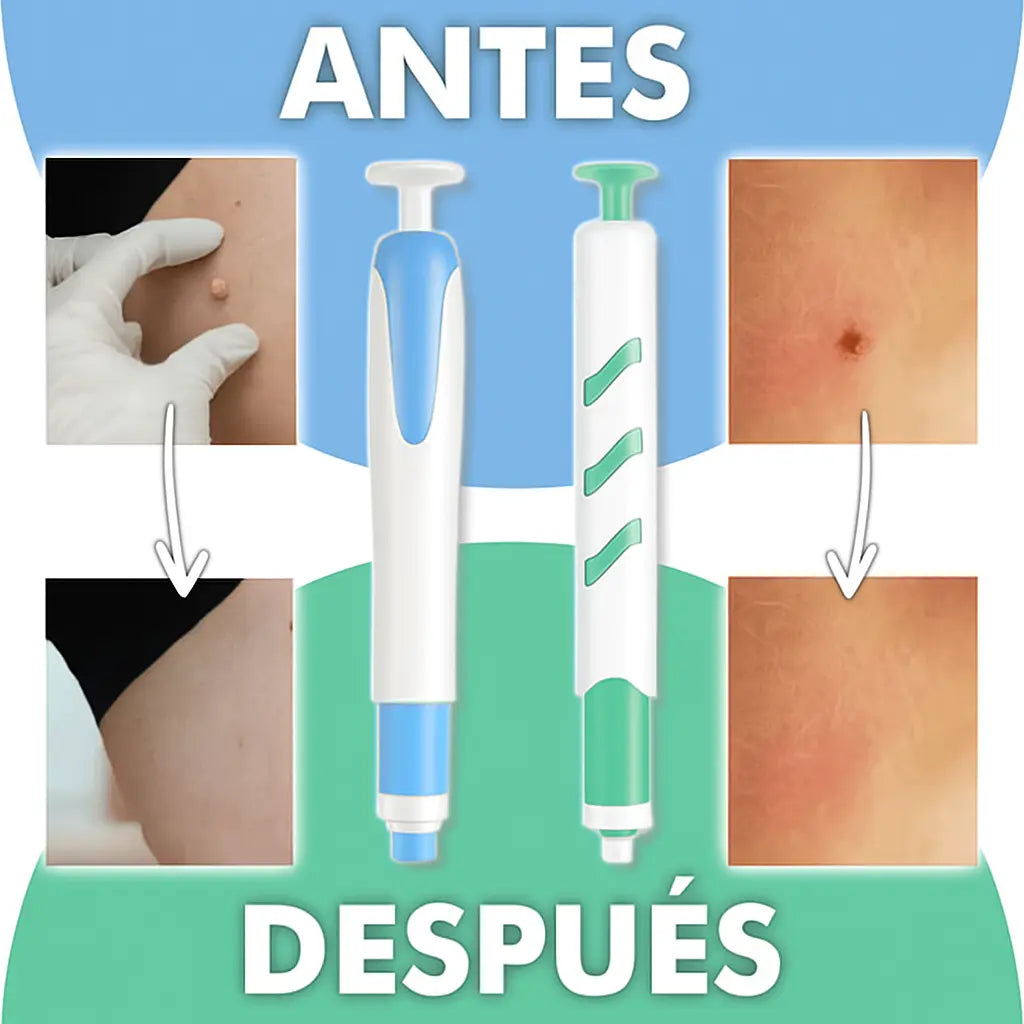 AutoSkin Tag - Lápiz para eliminar lunares y verrugas