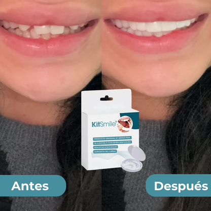 KitSmile® - Carillas Dentales (Kit Completo)