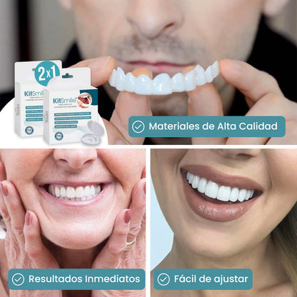 KitSmile® - Carillas Dentales (Kit Completo)