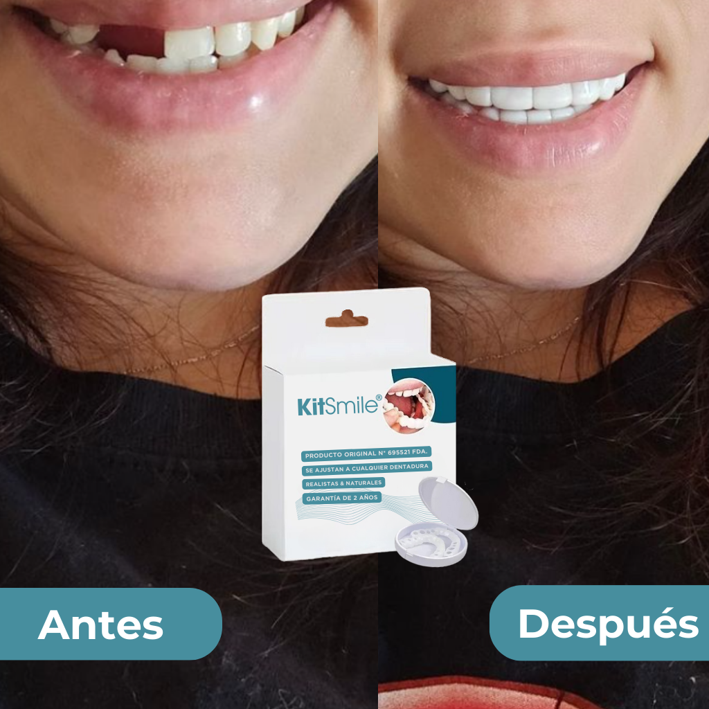 KitSmile® - Carillas Dentales (Kit Completo)