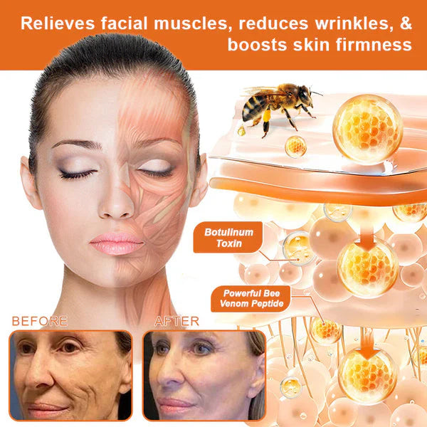 Flysmus Botox