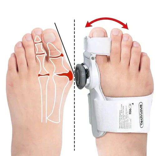 Corrector Ajustable de Juanetes (Bilateral) FootAligner™