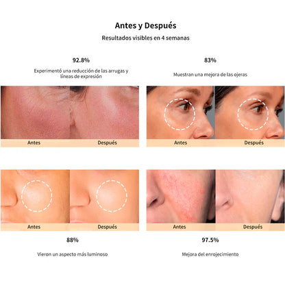 DermaPro 4D