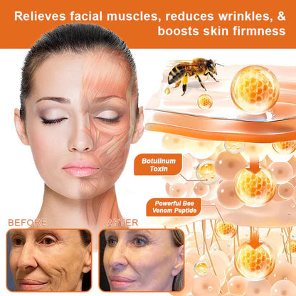 Flysmus Botox